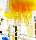 עירוי פלזמה - תמונת המחשה